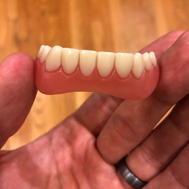Great Smile Veneer - Limited BOGO Deal