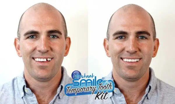 Instant Smile Triple Shade Temporary Tooth Kit - instant-smile-triple-shade-temporary-tooth-kit