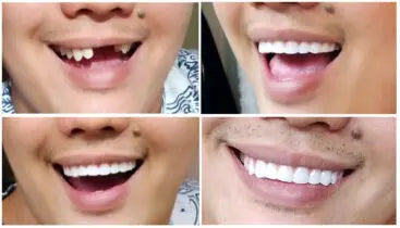 Instant Smile Comfort Fit Flex - instant-smile-comfort-fit-flex