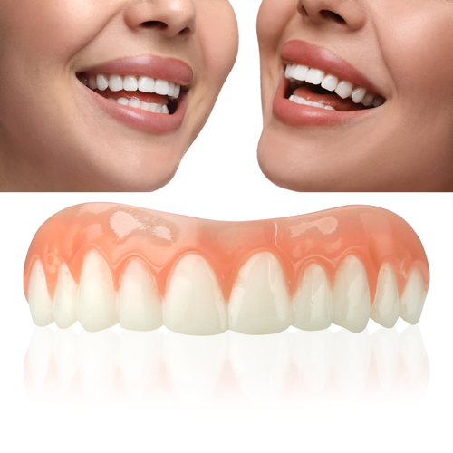 Great Smile Veneer (Upper Only)