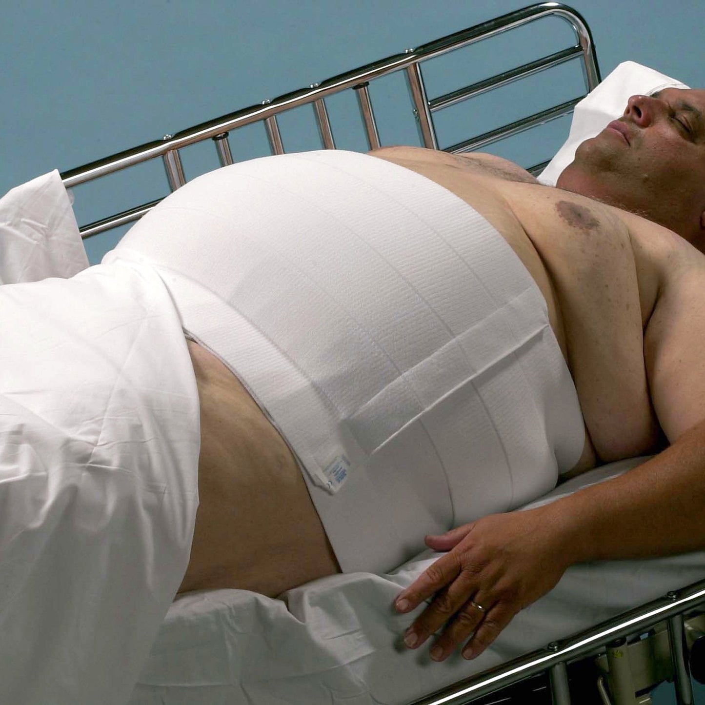 Abdominal Binder Dale Hook and Loop Closure 60 to 75 Inch Waist Circumference 12 Inch Height Adult,  Packaging Type- Box