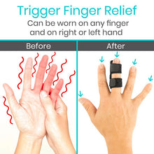 Load image into Gallery viewer, Universal Finger Splint
