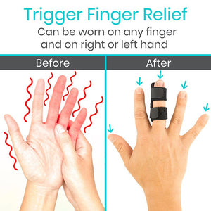 Universal Finger Splint - universal-finger-splint